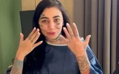 Türkiye’de estetik ameliyat sonrası ölen Mozambikli fenomen