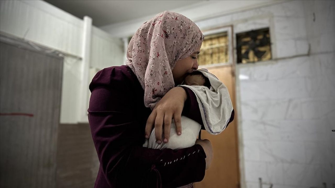 Gazze'deki Kıtlık 2 Aylık Bebek Rasil Ebu Mesud Öldü