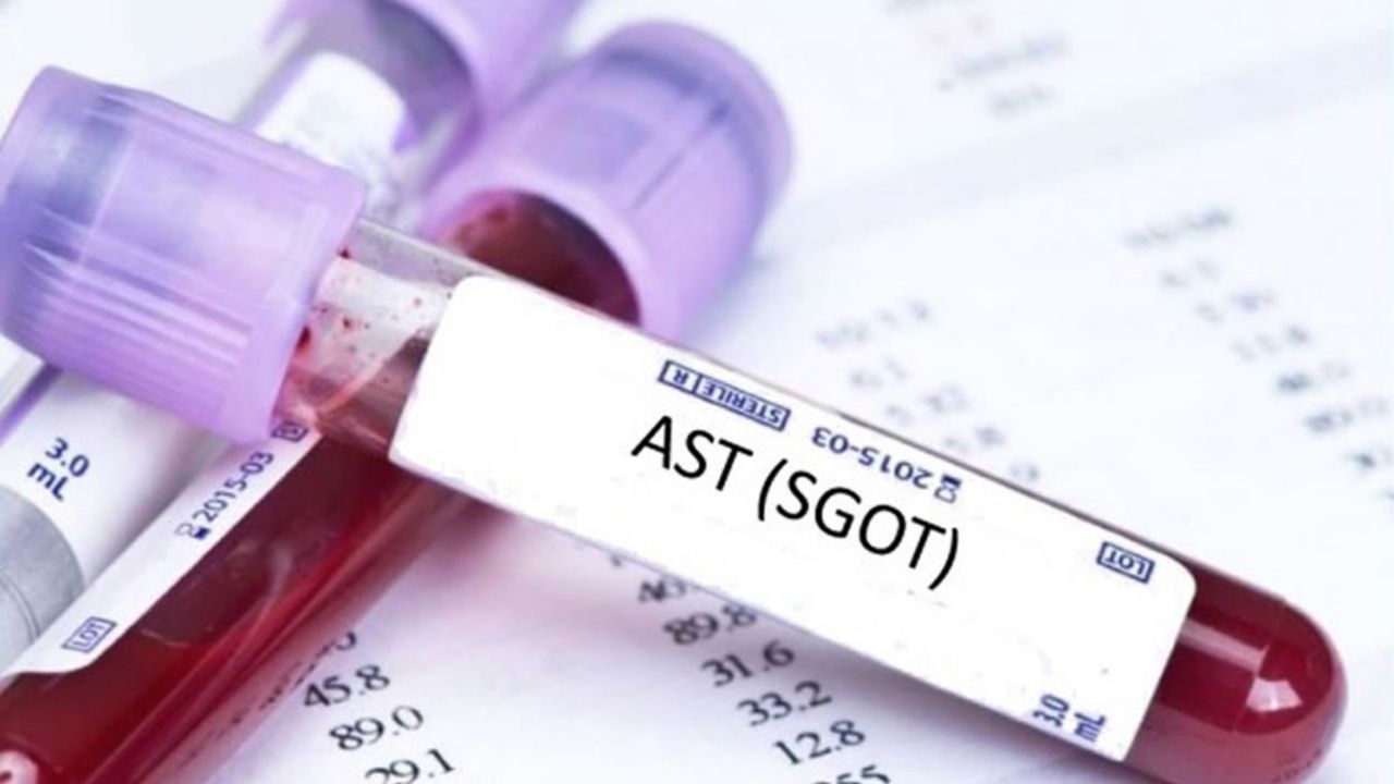 AST ve ALT Yüksekliği Nedir Yüksek AST ve ALT Değerleri Ne Anlama Gelir
