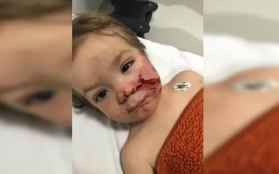 Pitbull Saldırısında 2 Çocuk Yaralandı